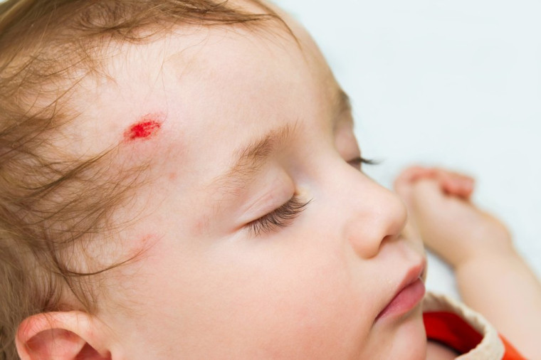 Самые частые травмы детей при ДТП: профилактика трагедий.